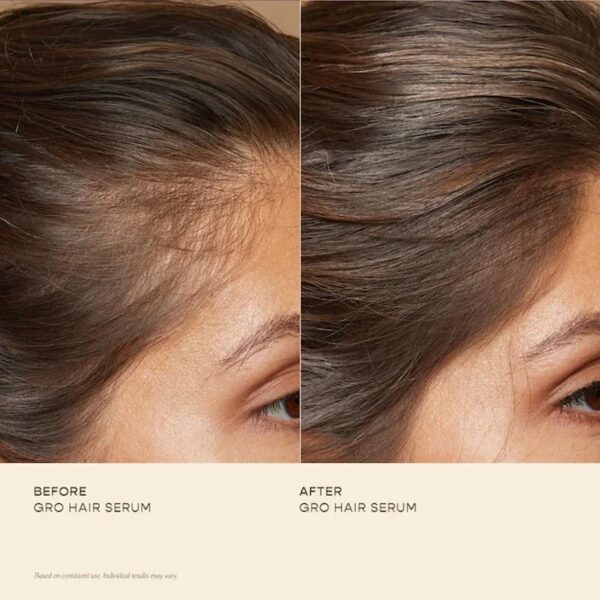 GRO Hair Serum - Image 4